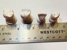 Vintage Dentist Tooth Models Dental Casts Lot Of 4 Chalk