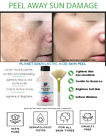 40  Pure Lactic Acid Skin Chemical Peel Kit And Free Fan Brush Dark Spot Reducer