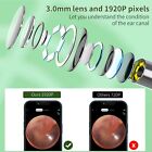 Ear Wax Removal Kit  1920p Hd Camera   8-pc Ear Set For Iphone  Ipad   Android