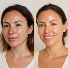 50  Glycolic Acid Chemical Skin Peel   Recovery Cream   Fan Brush