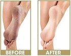 Prolinc Be Natural Callus Eliminator Original Pedicure 4 Fl  Oz    118 Ml