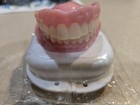     1 One Set Of 3d Small Adult Denture Kit    please Read Check   Your Measurements