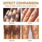 New Strong Whitening Cream For Removing Dark Knuckle Finger Elbow And Knee