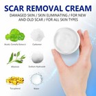Scar Removal Cream - Rapid Repair Of New   Old Scars  Acne Spots  Burns