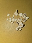 Human Teeth Bundle Decayed Adult And Children