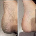 Nu Skin Nuskin Epoch Sole Solution Foot Treatment 4  Floz  Exp 05 2027