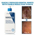 Oveallgo Body Firming Cream Nanolipo Hpv Genital Warts Cream For Men
