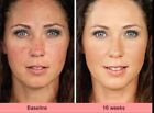 Kojic Acid Skin Whitening Lightening Ultra Brightening Serum Dark Spot Cream