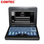 Usa Digital Portable Ultrasound Machine Laptop Scanner Convex linear 2 Probes