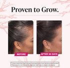 Viviscal Hair Growth Supplements For Women To Grow Thicker  Clinically Proven 