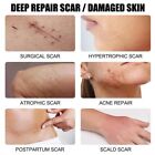 Best Scar Removal-cream For Old-scars Stretch Mark Removal Cream 50g