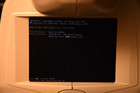 Topcon Trc   nw8 Fundus Retinal Camera W  Nikon   Monitor     Ophthalmology Imaging