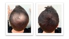 Caboki Hair Fibers For Thinning Hair     Natural Plantbased Hair Powder For Men   