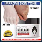 Authentic Kojie San Skin Brightening Cream     Original Kojic Acid Cream 50g Usa