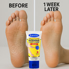 Aavini Foot Cream 50g     Repair Dry Cracked Heels  Deep Moisture   Odor Defense