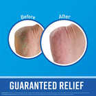 For Healthy Feet Foot Cream  Guaranteed Relief For Extremely Dry  Cracked Feet 