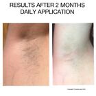 Hair Removal-permanent Hair Reduction inhibition  Back  Legs  Chest-unisex
