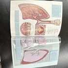American Cancer Society    cancer Invades    The Beleaguered Lung Booklet pamphlet