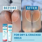 Heel Balm  Rich Moisturizing   Exfoliating Foot Cream  Original Version