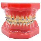 Dental Typodont Orthodontic Teeth Model Archwire Ligature Ties Metal Brackets Us