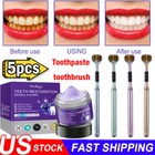 Dental Restoration Mineral Powder  Mineral Tooth Powder  Whitening-us Teeth
