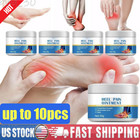 Feet Pain Relief Foot Cream Heel Pain Tendon Sheath Bone Spur Pain Cream 30g