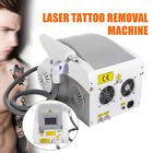 Q-switch Tattoo Remover Yag Laser Eyebrow Pigment Removal Face Beauty Machine