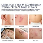 Advanced Scar Gel Effective For C-section  Stretch Marks  Acne  Surgery  07 2027
