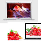 3x Hd Clear Screen Protector Cover Skin For 2020 Macbook Air Pro 11  13  14  15 