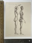 1864 Female Nervous System Oddity Print Litho Medical Anatomy German Doctor Art
