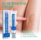Scar Removal Cream Skin Repair Acne Treatment Fade Stretch Markers Burns
