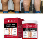 Varicose Veins Relief Cream Relieve Tired Legs Spider Pain Tighten Smooth Skin