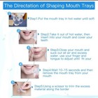 Professional Teeth Whitening Kit Tooth Whitener Gel Bleach White Dental System