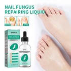 Nail Repair Serum Strengthening Nail Care Solution Nourishing Cuticle Oil