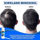 Kirkland Minoxidil 5  Xtra Strength-6 Month Supply Hair Regrowth Solution
