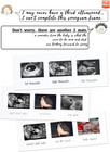 Triple Sonogram Pregnancy Frame     Baby Ultrasound Picture Frame With Story For E