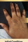 Skin Bleaching Cream For Dark Skin