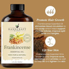 Frankincense Essential Oil Huge 4 Fl Oz 100  Pure And Natural