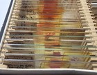 Antique Medical Pathology Laboratory Microscope Slides Kidney Liver Early 1900s