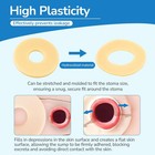Heagimed 10 Pcs Ostomy Barrier Ringsouter Diameter 2  50mm 2mm Thickness