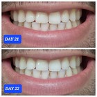 Whitestrips Professional Effects  Whitestrip 3d White  Teeth Whitening Strip Kit