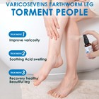 30ml Varicose Vein Spray Multi-purpose Knee And Leg Care Spray Promote Blood Cir