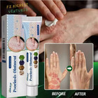 3x 20g Psoriasis Dermatitis Eczema Natural Cream Skin Treatment Ointment New