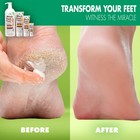 Miracle Foot Repair Cream  8 Oz  3 Pack  Dry Cracked Feet Cream  Aloe Vera