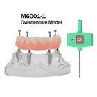 Dental Typodont Implant Restoration Overdenture Demo Practice Series Teeth Model