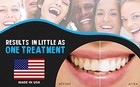 45  Professional Teeth Tooth Whitening Gel Carbamide Peroxide Refill Bleaching