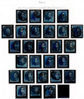 Belgium 1849-1861 Specialized Collection Of 64 Stamps All The First Imperf Value