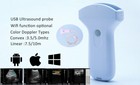 Wifi Wireless Usb Portable Handheld Color Doppler Ultrasound Linear Convex Probe