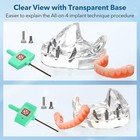 Dental All-on-4 Overdenture Implant Model Upper lower Jaw-clear With 4 Screw Usa