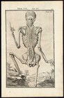 2 Rare Antique Anatomical Prints-muscle-back-man-layer-spigelius-casserius-1645